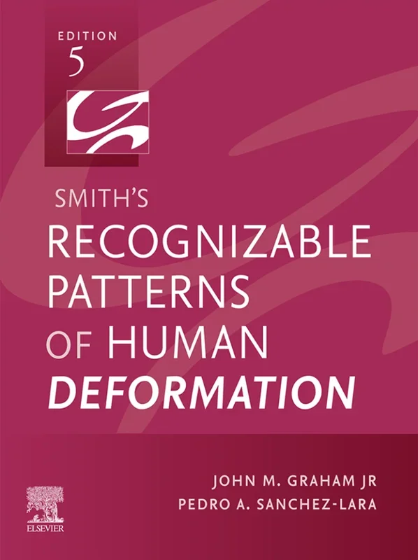 Smith's Recognizable Patterns of Human Deformation 5th Edition