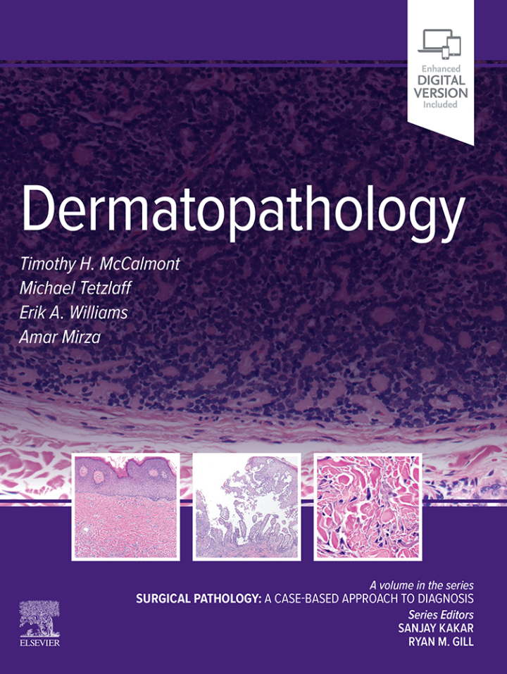 Dermatopathology: Surgical Pathology: A Case-Based Approach to Diagnosis